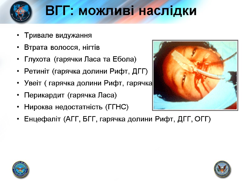 ВГГ: можливі наслідки Тривале видужання Втрата волосся, нігтів Глухота (гарячки Ласа та Ебола) Ретиніт